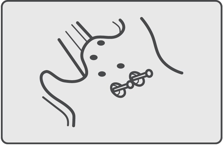 การยึดด้วยไม้บากเฉียง 45 องศา